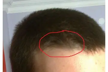 Saç Gülü Türleri ve Özellikleri